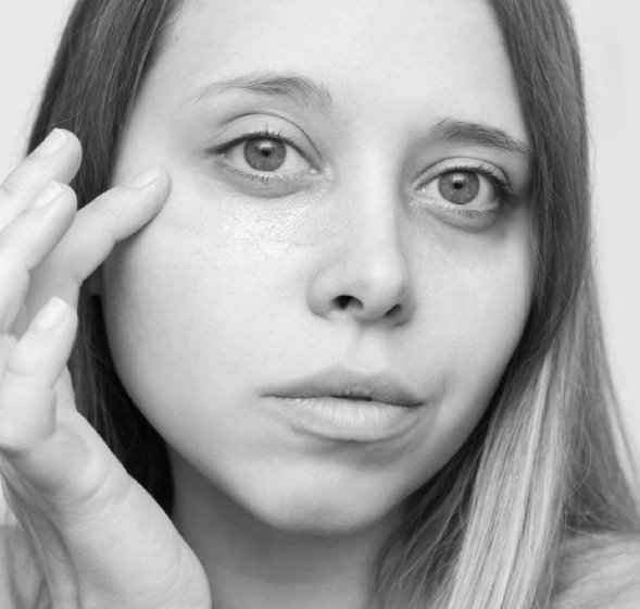 Dark Circles